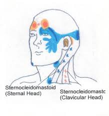 Head Neck And Shoulder Trigger Point Chart 4 Copyright