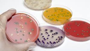 The listeria bacterium is able to enter and survive within immune cells such as macrophages. Cdc Declares Deadly Listeria Outbreak Over Soft Cheese To Blame Food Safety News
