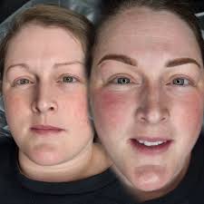 Ria James PMU Aesthetics & Medical Tattooing