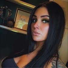 Two years ago today, my sweet patient @aggyabby shared her breast explant  story. Thank you for using your voice to spread awareness and help many  others. My entire staff and I are