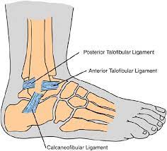 The patellofemoral articulation, consisting of the patella, or kneecap, and the patellar groove on the front of the femur through which it slides; What Is A Lateral Ankle Sprain Or Rolled Ankle North Lakes Health Hub