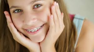 How long do braces take to straighten one tooth. Can I Get Braces Just On My Top Or Bottom Teeth Orthodontist