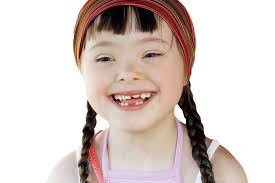 Um portador da síndrome de down normalmente apresenta as seguintes características, alem do retardo mental. Sindrome De Down Vida Longa E Saudavel Veja Saude