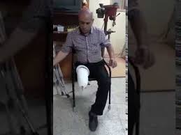 Hacettepe Ortopedi Protez Ayak Takma Ayak Youtube