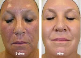 Professional Skincare