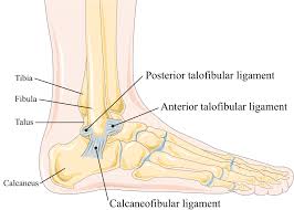 The biggest difference between a grade 2 and grade 3 ankle sprain is that in a grade 3 ankle sprain, a ligament is ruptured completely, where a grade 2 ankle sprain is only partially ruptured. Mio Therapy Ankle Sprain Guide