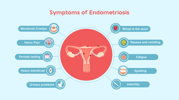 Endometriosis: Symptoms, Diagnosis, and Treatment - MatrikaIVF