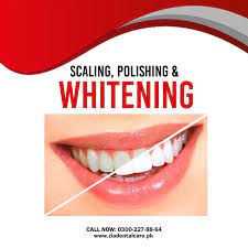 Pin On Cosmetic Dentistry