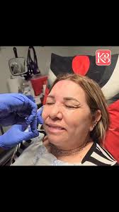 **Say Goodbye to Fine Lines & Hello to a Fresh Look this Easter!**At **KB  Body Solutions** we specialize in enhancing your natural beauty with  expertly administered **Botox treatments** for:- ...