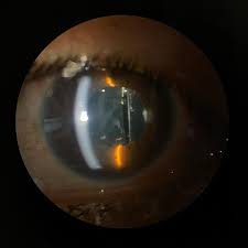 Image result for Pavetta cataractarum