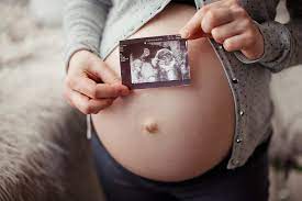 How To Handle An Umbilical Hernia In Pregnancy Parents
