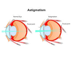 Preserving or restoring eye health is vital to our approach in every encounter with each patient. Visionary Eye Care Jonesboro Arkansas
