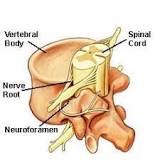 Image result for icd 10 code for foraminal narrowing cervical spine