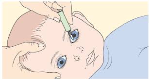 Compare prices for generic nicol eye drops substitutes: Chloramphenicol For Eye Infections Medicines For Children
