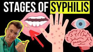 Image result for syphilis symptoms