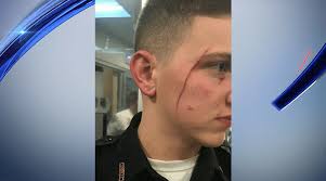 Correction officer slashed by Rikers inmate