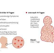 Die verfügbaren impfstoffe gegen das coronavirus haben eine hohe wirksamkeit. Masern Impfung Niedrige Impfquote In Ostdeutschland Gibt Ratsel Auf Welt