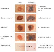 A skin lesion is any change in the normal character of your skin. Images Showing Comparison Between Benign And Malignant Skin Lesion Download Scientific Diagram