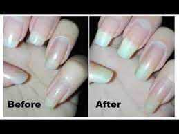 Yes, but you have to use them correctly so that the nail can actually absorb the nutrient. Diy Nail Hardener Tutorial How To Make Your Own Nail Strengthener Nail 101 Rose Pearl Youtube