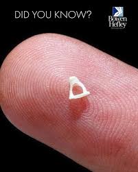 The stapes is the smallest bone in the human body, located in the middle ear and also known as the stirrup due to its shape. This tiny bone, which measures just a
