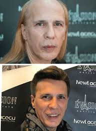 Pelucas Protesis Capilares NewLacecu