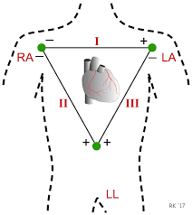 We did not find results for: Cv Physiology Electrocardiogram Standard Limb Leads Bipolar