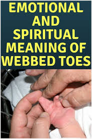 Well you're in luck, because here they come. Syndactyly Webbed Toes Spiritual Meaning Causes Spiritueel