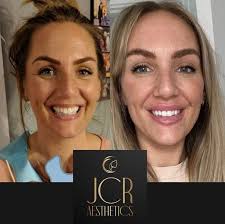 JCR Aesthetics, Joanne Rigby (@jcr_aesthetics) • Instagram photos and videos