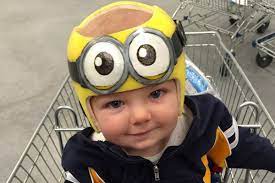 Baby Needs A Helmet 13 Things You Need To Know