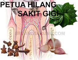 Apa akibat dari karang gigi? Petua Hilangkan Sakit Gigi Berdenyut Dengan Cara Semulajadi Bahan Bersifat Antiseptik Some Bullet For Your Head