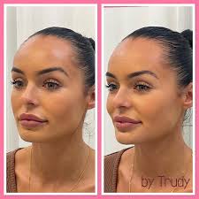 Nurse Trudy Muller 💉 (@skinulove) • Instagram photos and videos