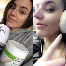 After 7 Days Of Herbalife Skin I M Reviving Herbalife Herbalife Results Herbalife Diet