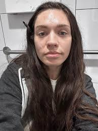 How Old do I look No Botox or fillers I'm a non smoker x