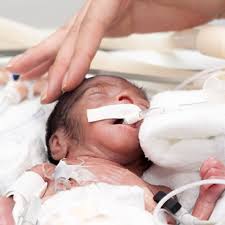 Prematuridade Como Fator De Risco A Paralisia Cerebral Interfisio
