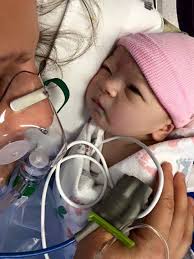 Premature birth story