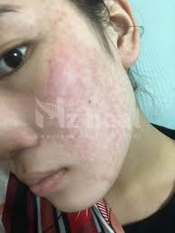 Manuka Skin Health Madeleine Ritchie