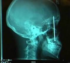 21 Real Crazy X Rays X Ray Strange Framing Nailers