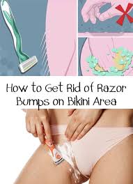 If You Shave Your Intimate Areas Then You Know How Annoying Are Irritations Caused By Shaving Find Out How Shaving Bikini Area Bikini Area Razor Bumps Bikini
