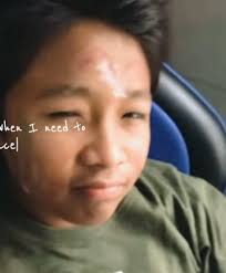 melvin sebelum jadi ade atta halilintar #melvindanendra #fyp #genhalilintar  #childhood @melvin thunder⚡️ @melpinalay