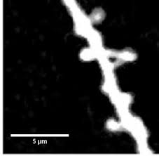 Dendritic Spines of Layer 5 Pyramidal Neurons of the Aging Somatosensory  Cortex Exhibit Reduced Volumetric Remodeling