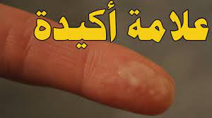 شكل افرازات بداية الحمل بالصور