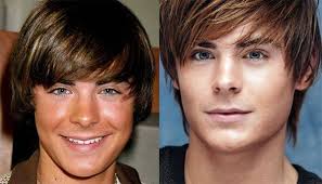 Which is often the case with many of these hollywood ilk. And Now Here Are Celebrity Plastic Surgeries Gone Good Celebrity Plastic Surgery Plastic Surgery Celebrities