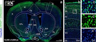235 просмотров 2 месяца назад. The Human Proteome In Mouse Brain The Human Protein Atlas