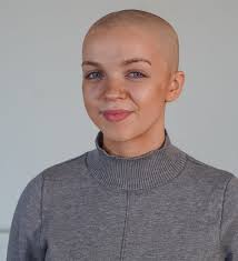 Teenager Marnie Wall becomes face of The Wonderful Wig Company