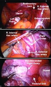 His teaching and concepts of pelvic anatomy have been widely acknowledged by surgeons and gynaecologists. Intraoperative Laparoscopic Photographs Conveying A Anatomical Download Scientific Diagram