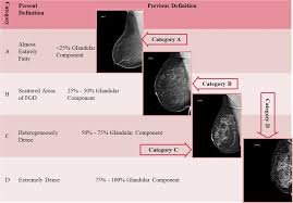Image result for Mammogram Interpretation