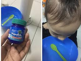 Selalunya, tiada ubat diberikan kepada bayi melainkan demam selsema ini berlarutan terlalu lama atau menimbulkan masalah kesihatan yang lain. Rawatan Alternatif Anak Selesema Hanya Guna Vicks Dan Air Panas Untuk Steam Cubalah Pa Ma
