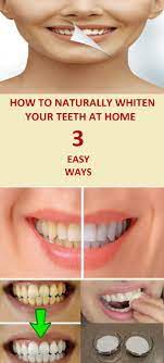 Improve overall oral hygiene 4. How To Strengthen Enamel And Whiten Teeth Arxiusarquitectura