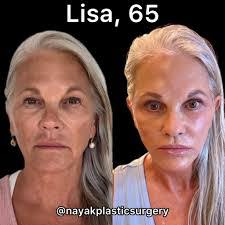 Jacqueline Lenhart's Instagram, Twitter & Facebook