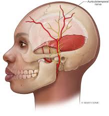 Narrative review of peripheral nerve blocks for the management of headache 